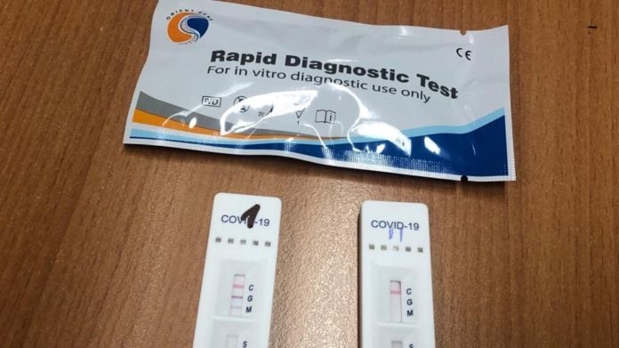 test-3 Unidades de test rápido para el coronavirus como las adquiridas por Castilla-La Mancha.