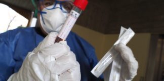 Test rápido de coronavirus.