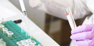 Prueba de coronavirus.