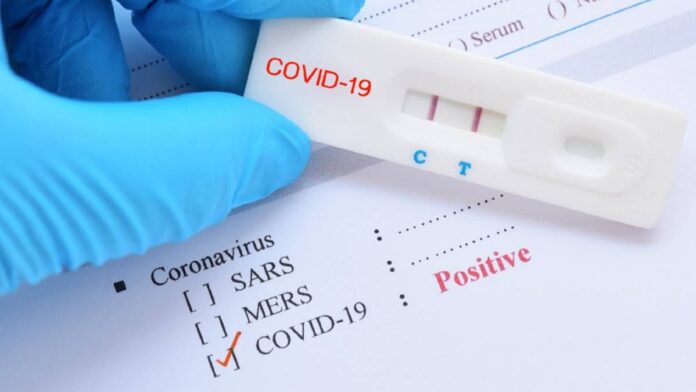 Test de coronavirus.