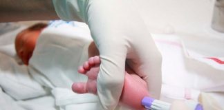Realización de la prueba del talón a un recién nacido.