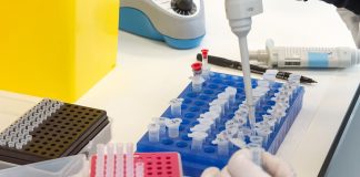 El lento descenso del COVID continúa: 288 de incidencia acumulada en la región Pruebas en un laboratorio.