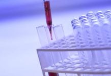 Primera piedra (metafóricamente hablando) del Centro de Innovación y Desarrollo Tecnológico de la provincia de Guadalajara Análisis en un laboratorio.