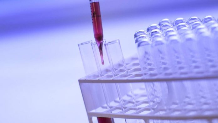 Análisis en un laboratorio.