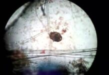 Ácaro de la sarna, al microscopio.