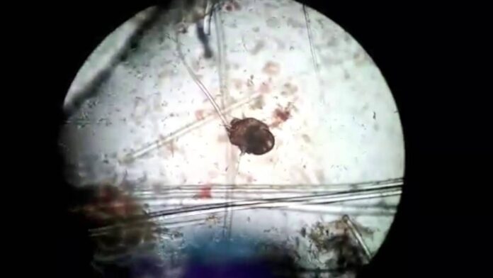 Ácaro de la sarna, al microscopio.
