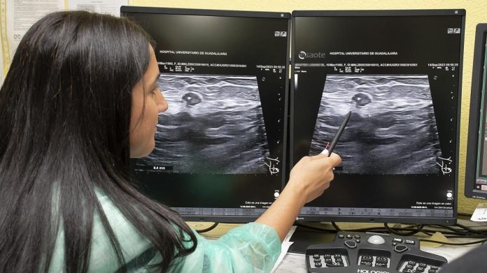Unidad de Mama del Hospital de Guadalajara, que innova en el tratamiento del cáncer.